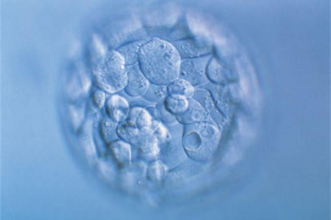 http://kunming.quanwangkm.com/post/190.html|昆明人工试管
